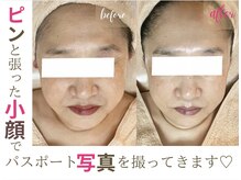 ソワンドビジュー(soin de bijew)/極上のインディバフェイシャル