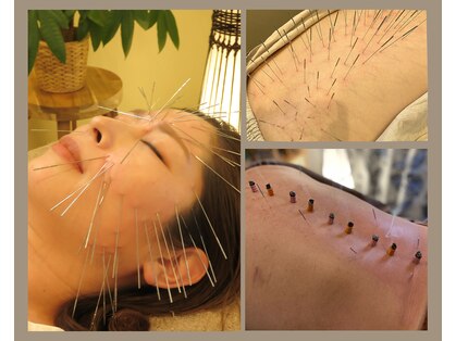 ぶあ鍼灸室の写真