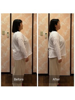 アリス(Alice)/全身矯正・骨格整体 60分