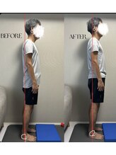 春日整体院ito/【姿勢改善ビフォーアフター】