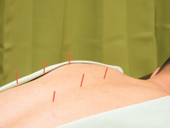 鍼灸J/O治療院 自由が丘の写真/鍼灸×整体の相乗効果で日頃の疲れや不調を徹底改善◎原因を見極め、効果的なアプローチを行います!