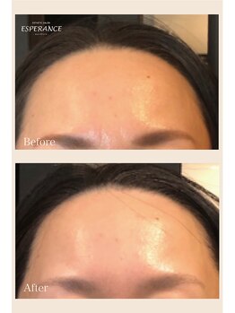 エステティックサロン エスぺランス(ESPERANCE)/Ravissaでツヤ肌へ