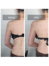 ソルーチェ(soluce)/リンパマッサージ背中