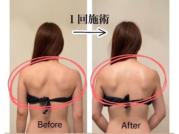 トータルボディケアアンドビューティー タイヨウ(TOTAL BODY CARE&BEAUTY TAIYO)/<ブライダルエステ>