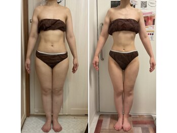 ラクシュミー/ビフォーアフター