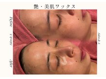 サロンドエー 帝塚山(Salon de A)/艶・美肌ワックス！