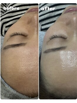 エミニー(Eminy)/ララピール