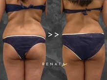 レナータ 大宮店(RENATA)/Before / After