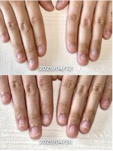 ポメロ(POMELO)/２週間でこの変化