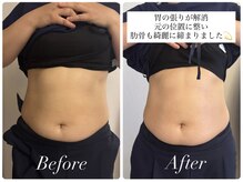 ネネ(Nene)/ビフォーアフター