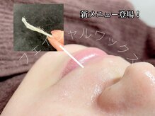 自己処理不要!全顔6600円/部分のみ可　額・鼻・鼻下・あご・両頬