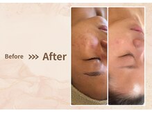 プラム(plum)/セルマン