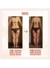 エメカシワ(Aimer KASHIWA)/50代　レモンハイパー半年の変化