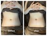 【オプション】便秘解消、下腹のぽっこりに　腸もみマッサージ10分　¥1,500