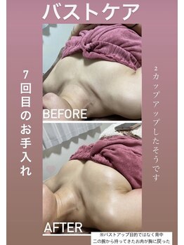 美顔秘密基地 新宮/バストケア