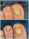 お客様のビフォーアフター写真