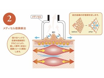 セルビューティー(Cell Beauty)/筋膜リリースで痩身