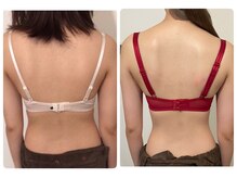 モナンジュ(ramonange)/バストアップbefore after