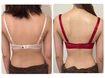 モナンジュ(ramonange)/バストアップbefore after