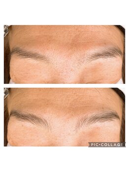 グランデ アム 八王子みなみ野店(Grande ame)/ブロウマッピング ワックス脱毛