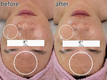 シャリル(charire)/若見え肌へ！透明感アップ