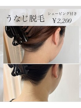 グランドシャルムエス(Grand Charme S)/うなじ脱毛