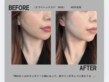 ネムリビト/ヘッドスパでお顔スッキリ