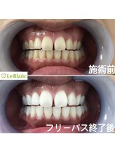 ルブラン 奈良店(Le Blanc)/歯のお手入れを習慣に
