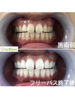 ルブラン 奈良店(Le Blanc)/歯のお手入れを習慣に