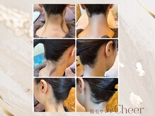 チア(Cheer)/うなじワックス