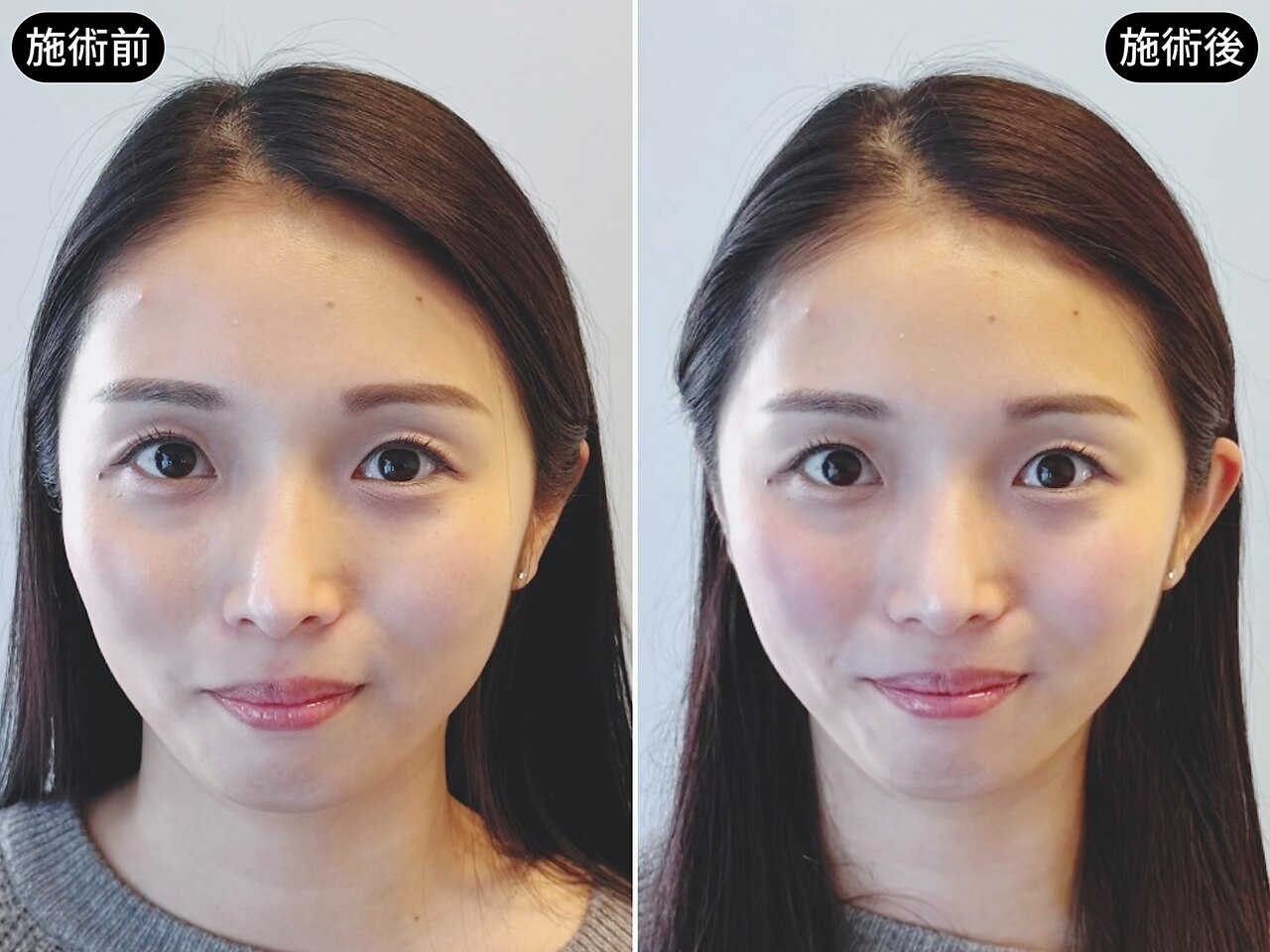 アオヤマ サロン ワイゼット(AOYAMA SALON YZ)｜ホットペッパー
