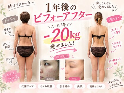 ヨサパーク シピ(YOSAOARK Chipie)の写真