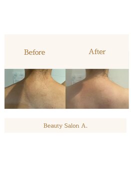 エードット 銀座(A.)/首長効果