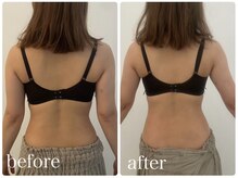 美人バスト 渋谷店/【痩身・ダイエット】渋谷/お腹