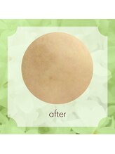 ビューティフィーサロン ベルル(Belulu)/オーダーメイドFアフター