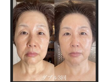 サロンドココリール(salon de cocorire)/Lit ダブル3回