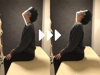 ミライズ整体院 三宮本院/事例【20代男性・急な首痛】