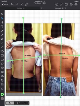 土井接骨院 本店/不可能と言われた側湾が快癒YD！