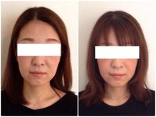 ウェリナ平和堂長久手院/小顔矯正/骨盤矯正/美脚サロン