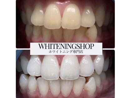 ホワイトニングショップ 明石大久保店の写真