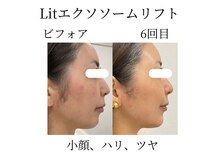 フラワー(FLOWER)