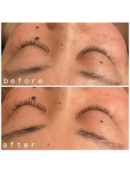 メナードフェイシャルサロン 岐阜茜部/炭酸パック