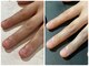 ジョイア(joia)の写真/巻き爪・深爪など爪のお悩みがある方におすすめ☆高技術スタッフが健康的な美爪に導きます♪