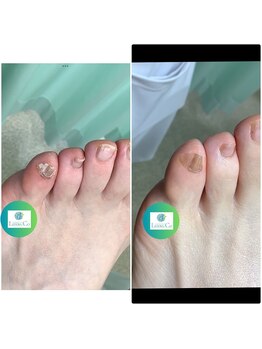 リゼラアンドコー 池袋店/ネイルキュアコース