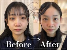 R-1ビューティーサロン 表参道/Before＆After