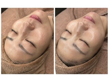 シャルマン(Charmant)/befoer、after