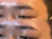 スリーピース(3Peace)/ストレート眉 Before/After