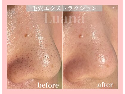 ルアナ(Luana)の写真