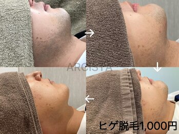 アルシスタ(ARCISTA)