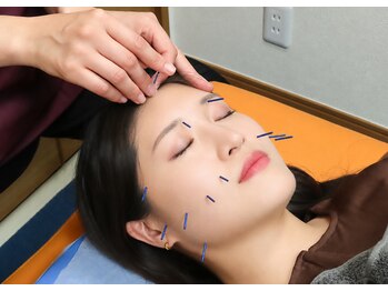 東垣鍼院の写真/【コスメコンシェルジュ資格保有/女性鍼灸師在籍♪】女性特有のお悩みや細かな肌トラブルもご相談下さい◎